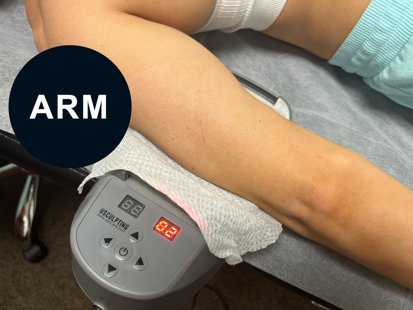 High-Intensity Electromagnetic Fat Burner & Muscle Stimulator – Advanced Fat Reduction, Muscle Growth, Pain Relief – Safe for Arms, Thighs, Calves – 30-Minute Treatment Cycle – Home Use